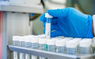 Press Release: Upscale of SARS-CoV-2 testing capacity in the Netherlands