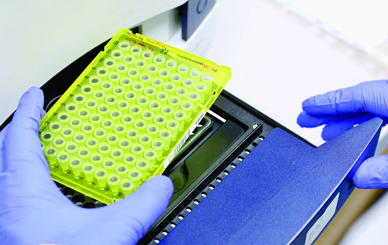 PlexPrime® SARS-CoV-2 AlphaBetaGamma+